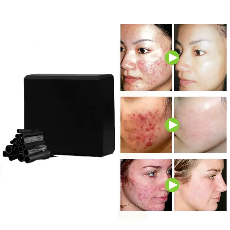 Bamboo Charcoal Cleansing Bar